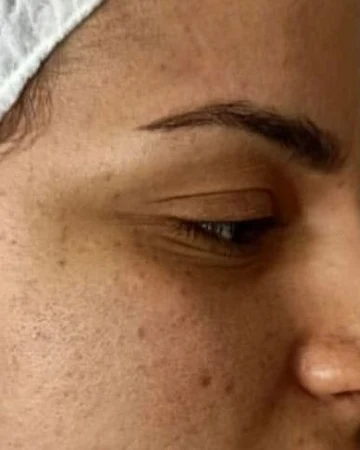 Soin du visage, avant